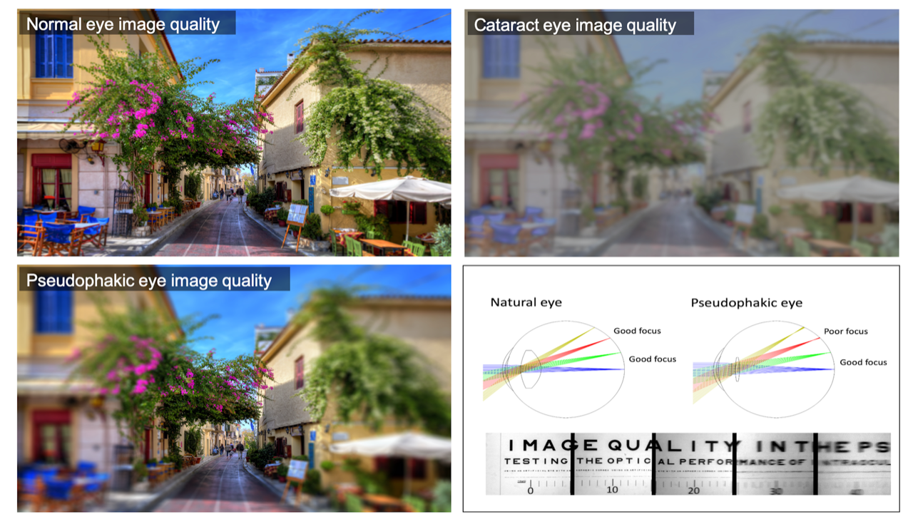 Quality Visual Image PeriVIQA – Peripheral Visual and Image Quality Assessment